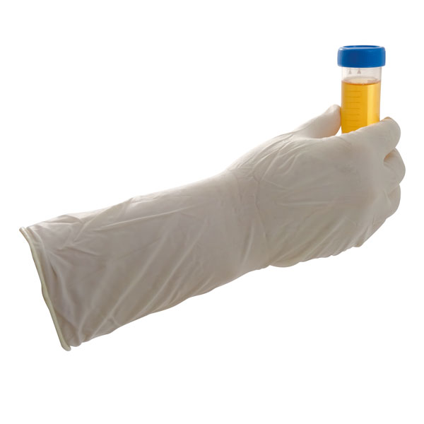 Urea GEN